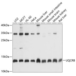 UQCRB Rabbit pAb