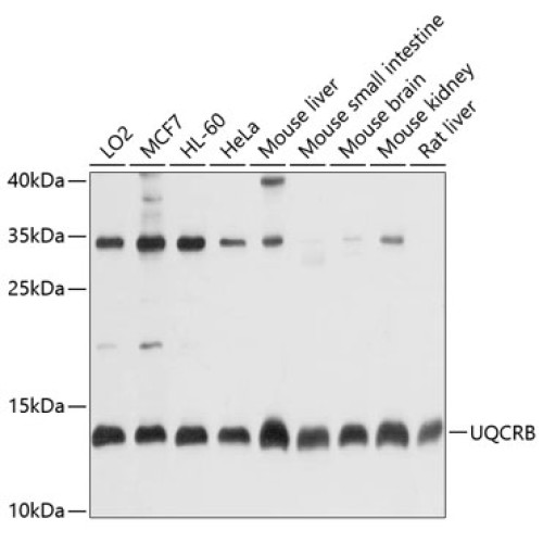 UQCRB Rabbit pAb