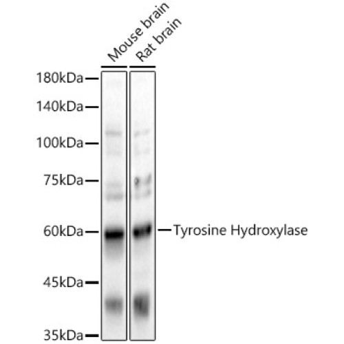 Tyrosine Hydroxylase Rabbit pAb