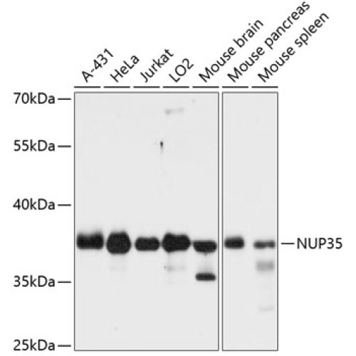 NUP35 Rabbit pAb