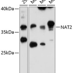 NAT2 Rabbit pAb
