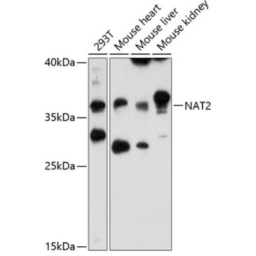 NAT2 Rabbit pAb