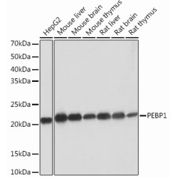 PEBP1 Rabbit mAb
