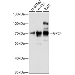 GPC4 Rabbit pAb