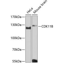CDK11B Rabbit pAb