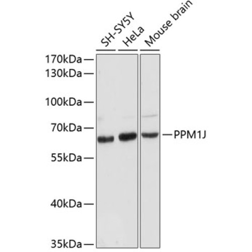 PPM1J Rabbit pAb