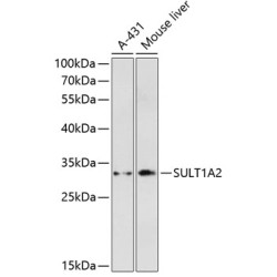 SULT1A2 Rabbit pAb