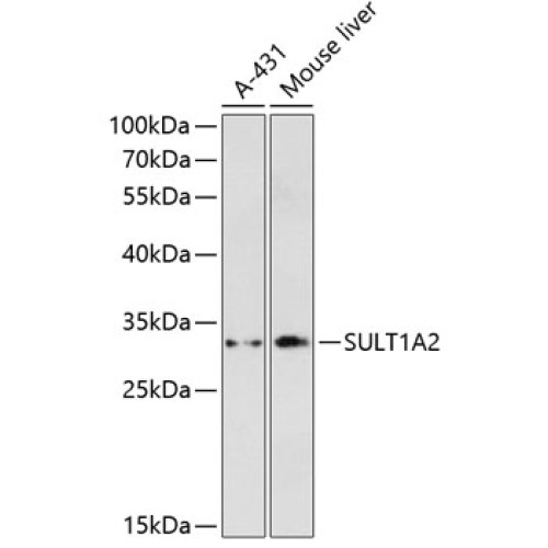 SULT1A2 Rabbit pAb