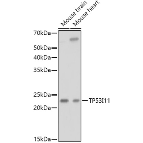 TP53I11 Rabbit pAb