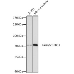 Kaiso/ZBTB33 Rabbit pAb