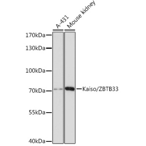 Kaiso/ZBTB33 Rabbit pAb