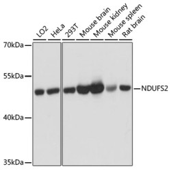[KO Validated] NDUFS2 Rabbit pAb