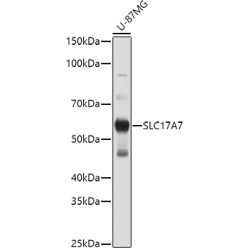 SLC17A7 Rabbit pAb
