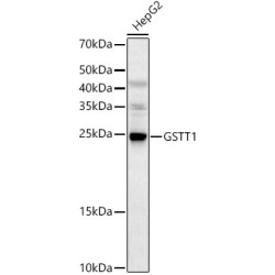 GSTT1 Rabbit pAb