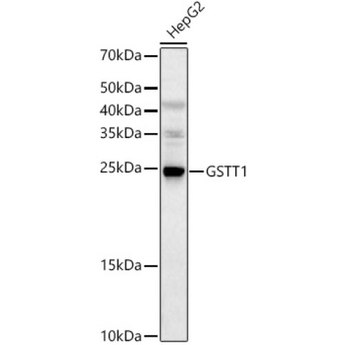 GSTT1 Rabbit pAb