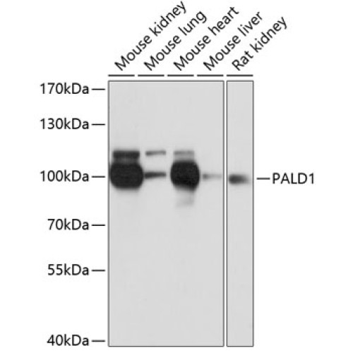 PALD1 Rabbit pAb