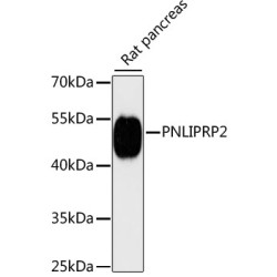 PNLIPRP2 Rabbit pAb
