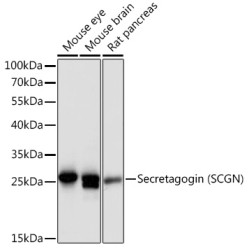 Secretagogin (SCGN) Rabbit pAb