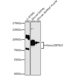 Kaiso/ZBTB33 Rabbit pAb