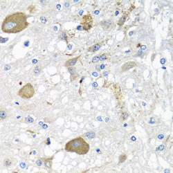 IFNL3 Rabbit pAb
