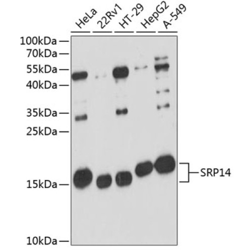 SRP14 Rabbit pAb