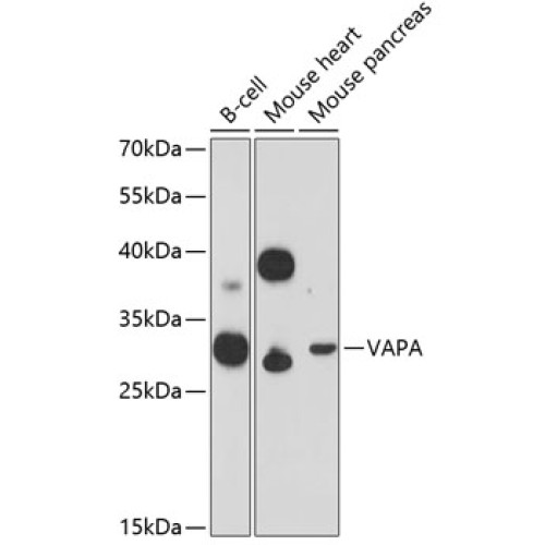 VAPA Rabbit pAb