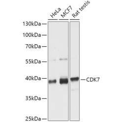 [KO Validated] CDK7 Rabbit pAb