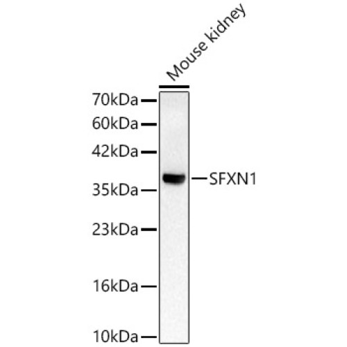 SFXN1 Rabbit pAb