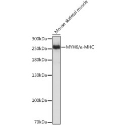 MYH6/α-MHC Rabbit pAb