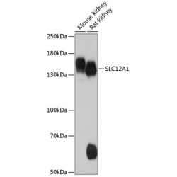 SLC12A1 Rabbit pAb