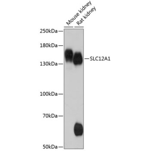 SLC12A1 Rabbit pAb