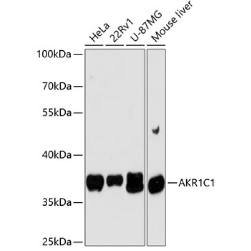 AKR1C1 Rabbit pAb