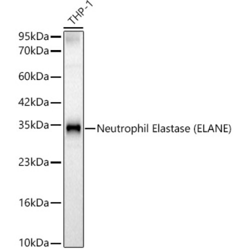 Neutrophil Elastase (ELANE) Rabbit pAb