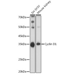 Cyclin D1 Rabbit pAb