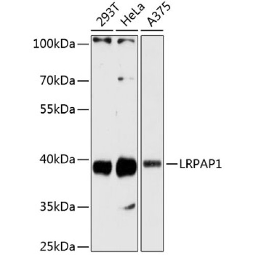 LRPAP1 Rabbit pAb