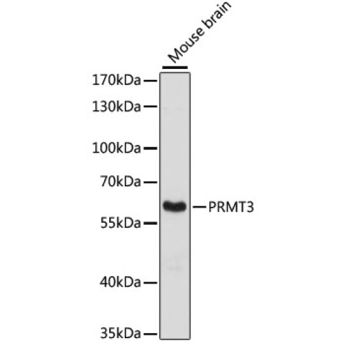 [KO Validated] PRMT3 Rabbit pAb