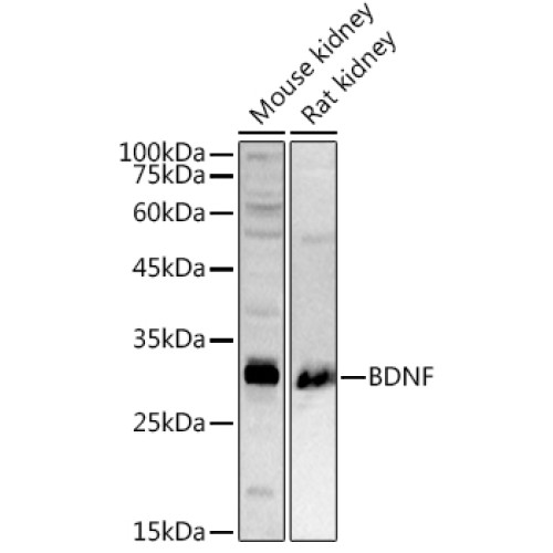 BDNF Rabbit pAb