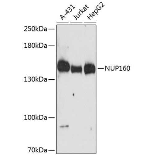 NUP160 Rabbit pAb
