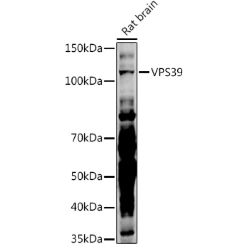 VPS39 Rabbit pAb
