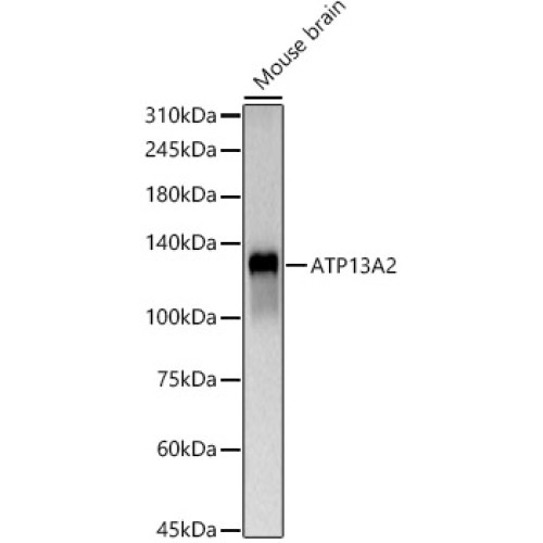 ATP13A2 Rabbit pAb