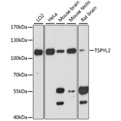 TSPYL2 Rabbit pAb