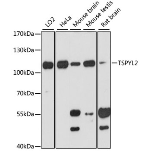 TSPYL2 Rabbit pAb