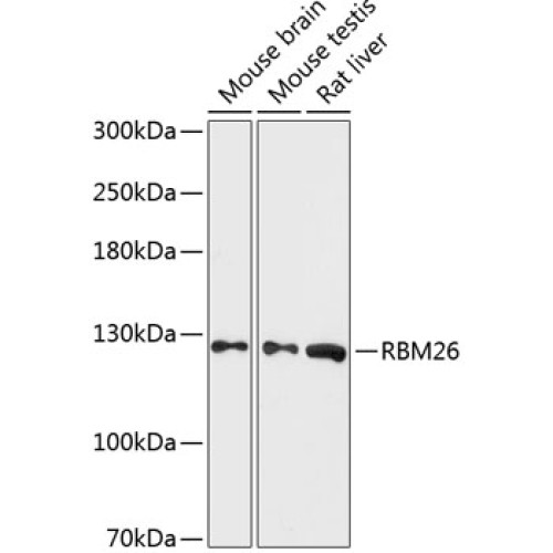 RBM26 Rabbit pAb