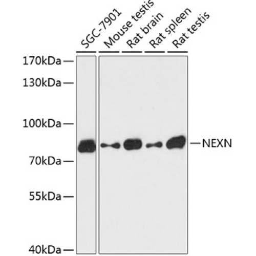 NEXN Rabbit pAb