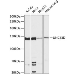UNC13D Rabbit pAb