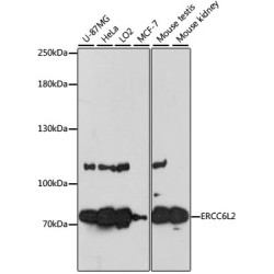 ERCC6L2 Rabbit pAb