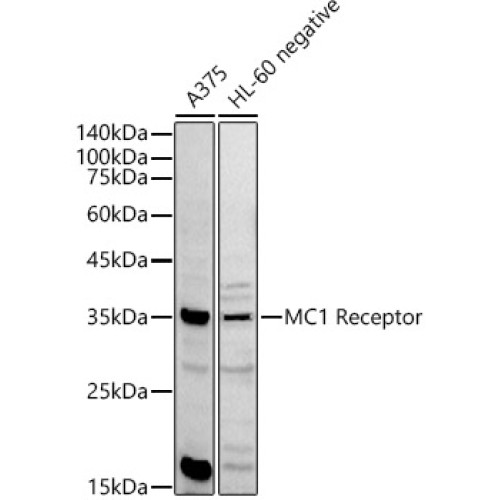 MC1 Receptor Rabbit pAb