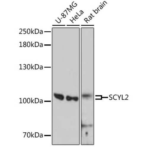 SCYL2 Rabbit pAb