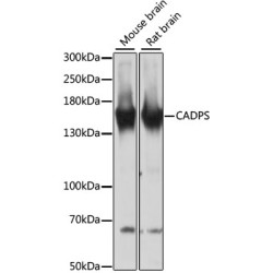 CADPS Rabbit pAb