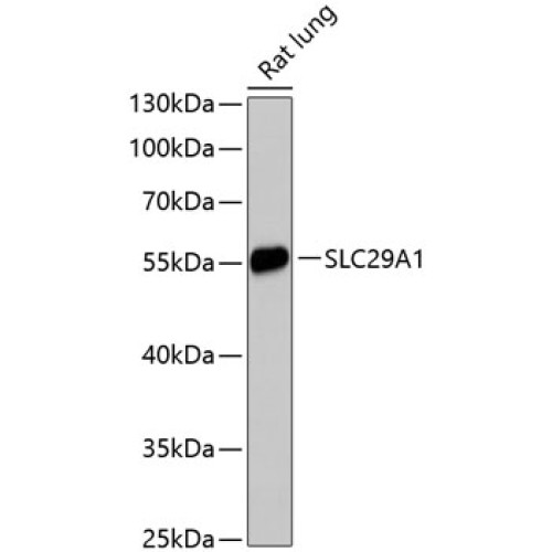 SLC29A1 Rabbit pAb